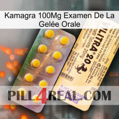 Kamagra 100Mg Examen De La Gelée Orale new06